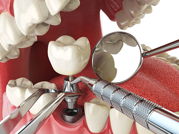 Best Emergency Gum Treatment in Lechee, AZ